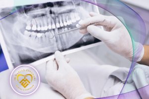 تصویربرداری اشعه ایکس دندان