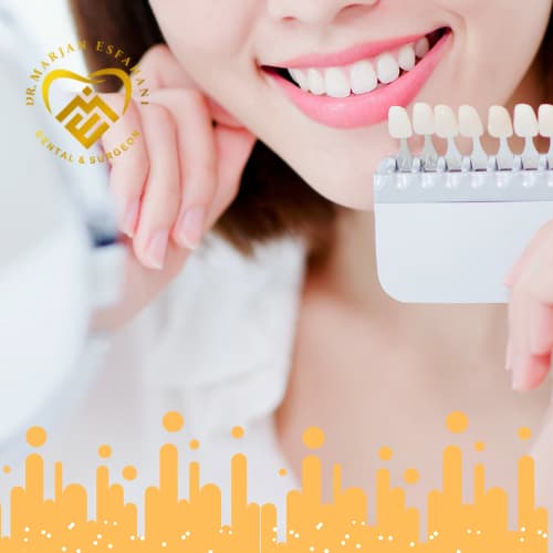 تعریف کامپوزیت و انواع آن