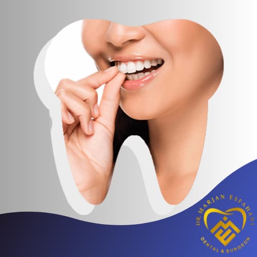 روکش کردن دندان