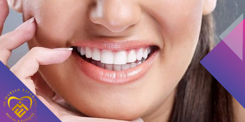 عوارض لمینت دندان